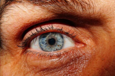 علاج الكلوجوما والمياه الزرقاء في العين بالاعشاب